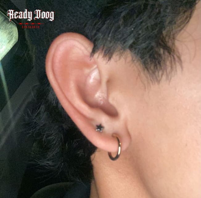 ARETES